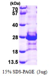 Human CacyBP protein, His tag. GTX68392-pro