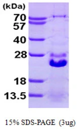 Human HSPB7 protein, His tag. GTX68394-pro