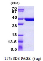 Human SULT1C4 protein, His tag. GTX68398-pro