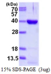 Human DIMT1 protein, His tag. GTX68409-pro