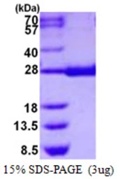 Human HPGDS protein, His tag. GTX68411-pro