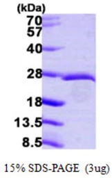 Human EIF3K protein, His tag. GTX68412-pro