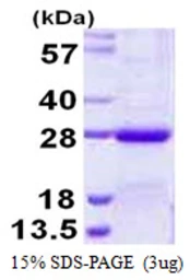 Human NKIRAS2 protein, His tag. GTX68417-pro