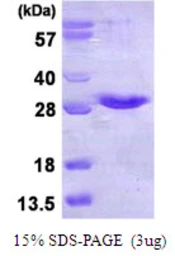Human NKIRAS1 protein, His tag. GTX68418-pro