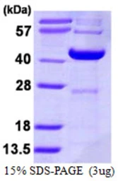 Human DCPS protein, His tag. GTX68421-pro