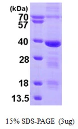 Human MED4 protein, His tag. GTX68426-pro