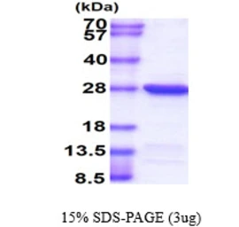 Human UBE2T protein, His tag. GTX68430-pro