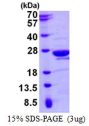 Human MOG1 protein, His tag. GTX68434-pro