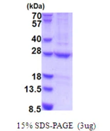Human HEMK2 protein, His tag. GTX68437-pro