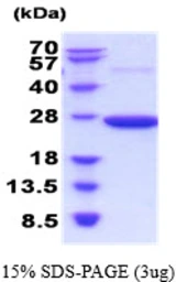 Rat PRX II protein, His tag. GTX68441-pro