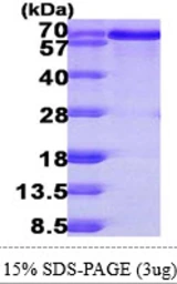 Human BLNK protein, His tag. GTX68442-pro