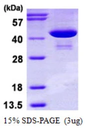 Human PSAT1 protein, His tag. GTX68451-pro