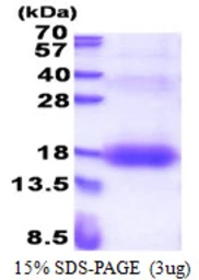 Human ZNRD1 protein, His tag. GTX68454-pro