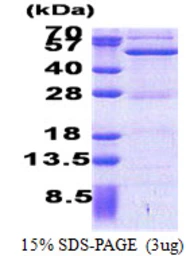 Human ASCC1 protein, His tag. GTX68462-pro