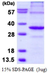 Human APIP protein, His tag. GTX68471-pro