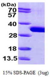 Human SBDS protein, His tag. GTX68476-pro