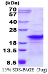Human RPL26L1 protein, His tag. GTX68477-pro