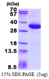 Human MRTO4 protein, His tag. GTX68481-pro