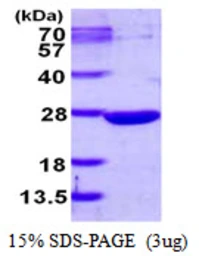 Human DUSP13 protein, His tag. GTX68486-pro