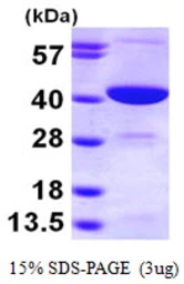 Human GMPR2 protein, His tag. GTX68499-pro