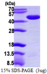 Human PPME1 protein, His tag. GTX68506-pro