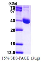 Human LCMT1 protein, His tag. GTX68508-pro