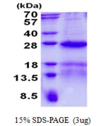 Human HSPC111 protein, His tag. GTX68510-pro