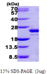 Human UFC1 protein, His tag. GTX68512-pro
