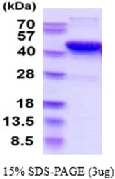 Human SIRT6 protein, His tag. GTX68517-pro