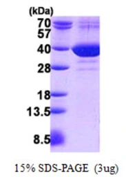 Human FAM49B protein, His tag. GTX68523-pro
