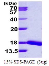 Human UBE2D4 protein, His tag. GTX68525-pro