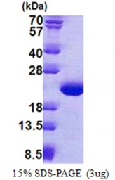 Human TPPP3 protein, His tag. GTX68530-pro