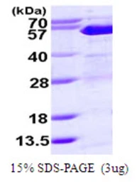 Human Suppressor of Fused protein, His tag. GTX68531-pro