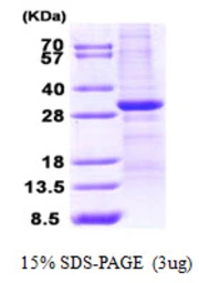Human WWOX protein, His tag. GTX68538-pro
