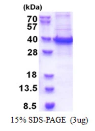Human RBM11 protein, His tag. GTX68541-pro