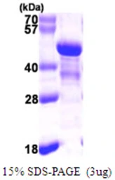 Human NDE1 protein, His tag. GTX68560-pro