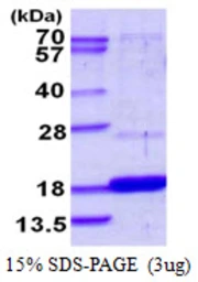 Human DUSP23 protein, His tag. GTX68566-pro