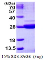 Human Nicotinamide riboside kinase 1 protein, His tag. GTX68570-pro
