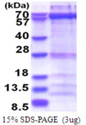 Human ZWILCH protein, His tag. GTX68573-pro