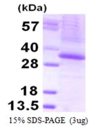 Human THAP1 protein, His tag. GTX68575-pro