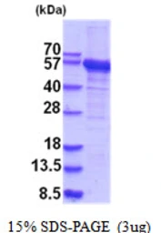 Human RNMTL1 protein, His tag. GTX68577-pro