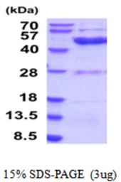 Human ETNK2 protein, His tag. GTX68582-pro