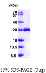 Human MOB1A protein, His tag. GTX68583-pro