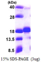 Human UBE2W protein, His tag. GTX68589-pro