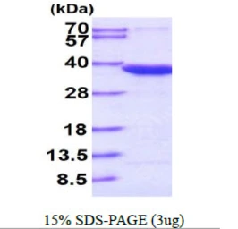 Human OTUB1 protein, His tag. GTX68599-pro