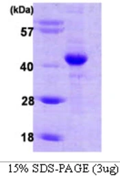 Human HIF1AN protein. GTX68604-pro