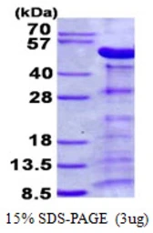 Human Parvin alpha protein, His tag. GTX68609-pro