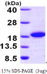 Human THEM2 protein, His tag. GTX68616-pro