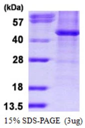 Human HDAC8 protein, His tag. GTX68620-pro