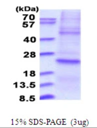 Human DUSP22 protein, His tag. GTX68641-pro